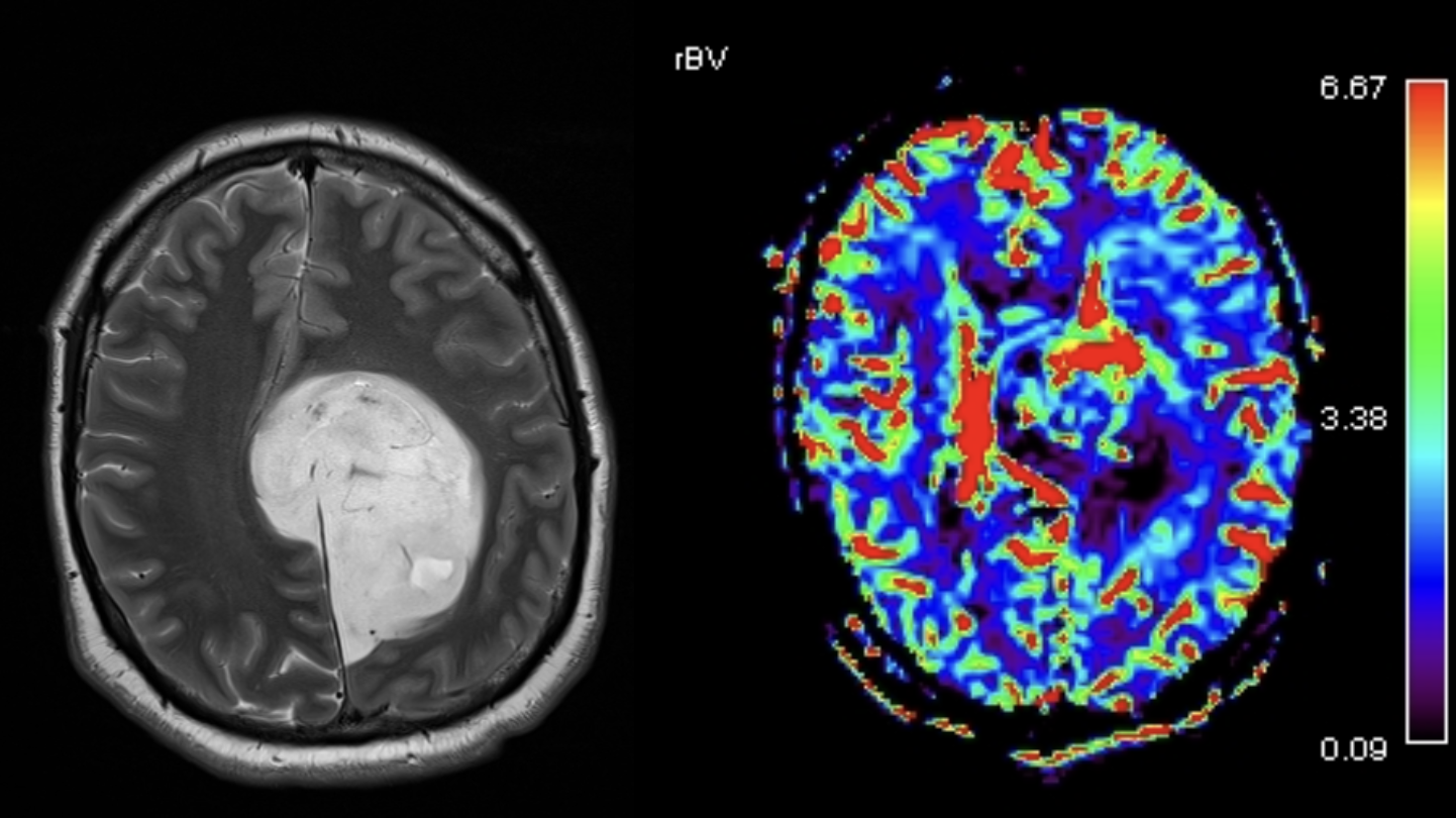 preoperator7DorinBica